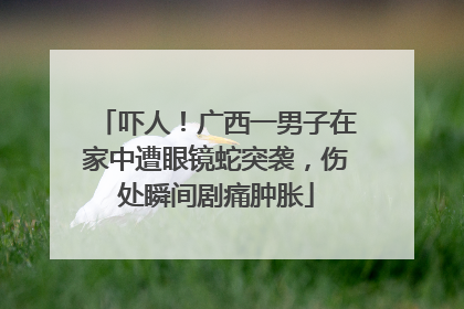 吓人！广西一男子在家中遭眼镜蛇突袭，伤处瞬间剧痛肿胀